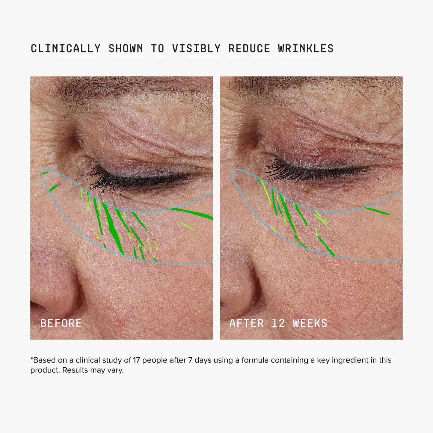 Needle-less® Growth Factor Serum